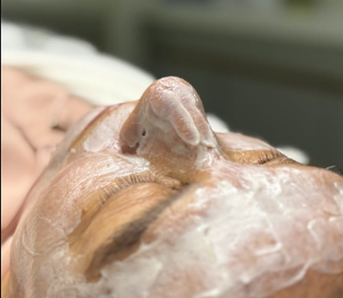 Limpeza de pele em andamento no consultório